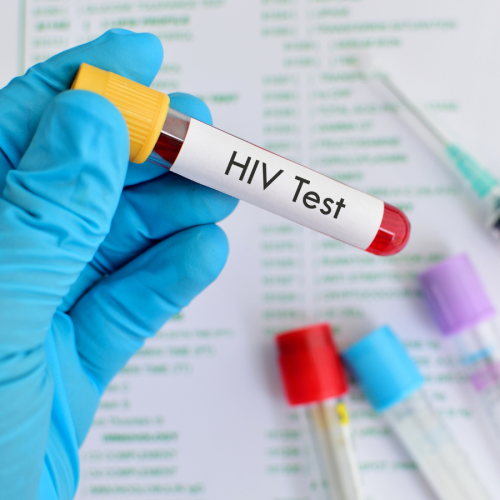 Determinación VIH